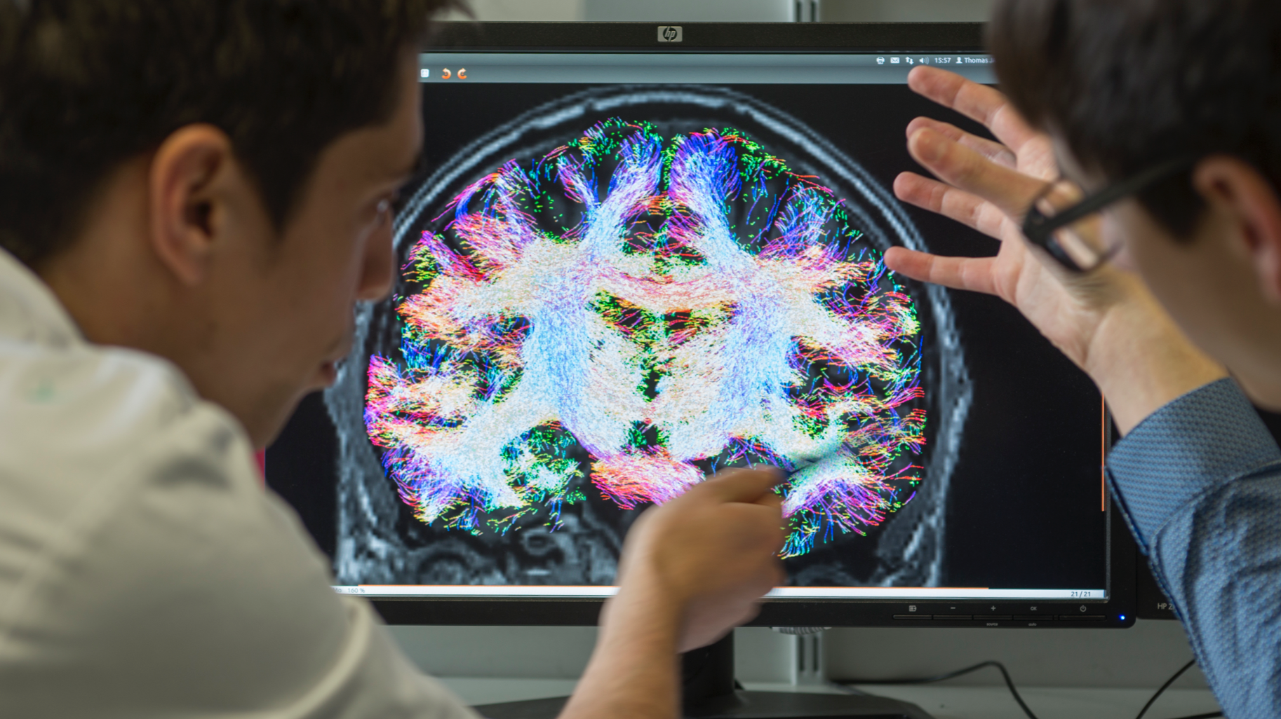 Scientifiques devant une radiographie de cerveau