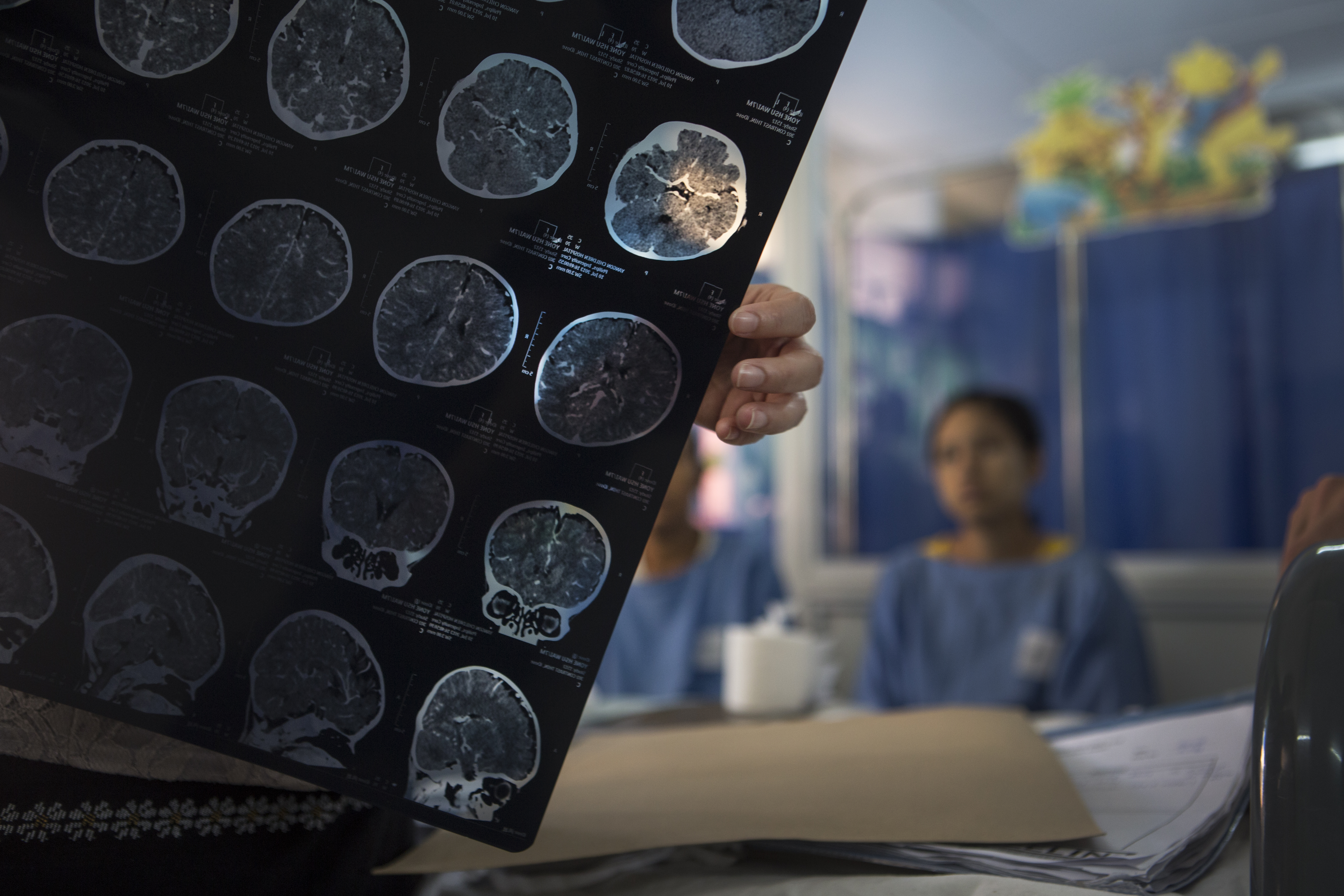 Hôpital Pédiatrique de Yangon, Birmanie. Les médecins analysent les résultats du scanner cérébral d'un jeune patient souffrant d'encéphalite. 