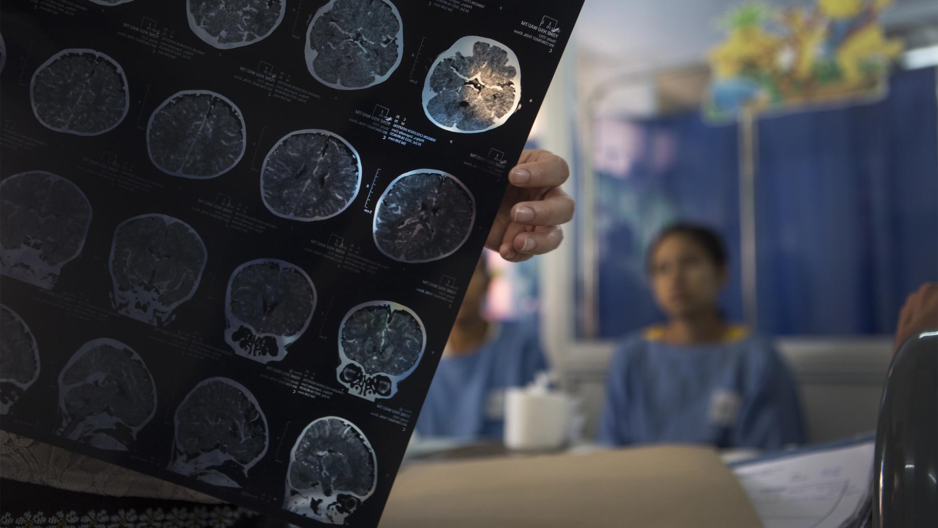 Scanner cérébral d'un patient étudié par des médecins