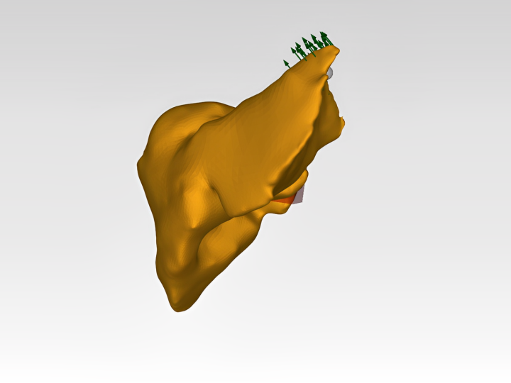 Simulation interactive de déformation du foie pilotée par réseau de neurones